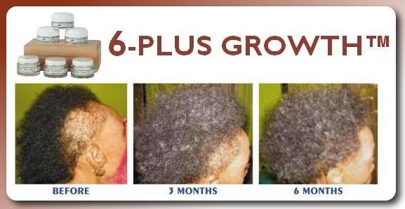 hair-growth-banner-final-.jpg