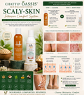 CHATTO® OASSIS™ Scaly-Skin Intensive Comfort System